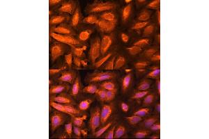 Immunofluorescence analysis of U-2 OS cells using DTYMK Rabbit pAb (ABIN6133500, ABIN6139855, ABIN6139856 and ABIN6221989) at dilution of 1:100 (40x lens). (DTYMK Antikörper  (AA 1-212))