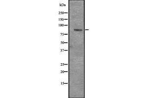Western blot analysis of CENPI expression in Hela cell lysate,The lane on the left is treated with the antigen-specific peptide.
