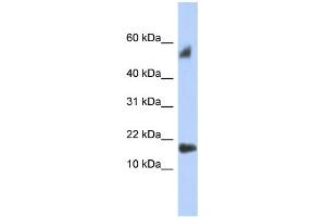 WB Suggested Anti-FLJ35767 Antibody Titration: 0. (FLJ35767 (Middle Region) Antikörper)