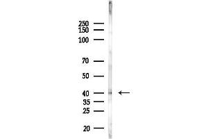 anti-Methyl-CpG Binding Domain Protein 2 (MBD2) (Internal Region) antibody