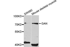 Western blot analysis of extract of SW480 and mouse skeletal muscle cells, using GAN antibody. (GAN Antikörper)