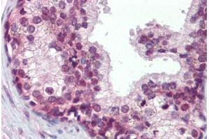 Human Prostate (formalin-fixed, paraffin-embedded) stained with ELF4 antibody ABIN462321 followed by biotinylated goat anti-rabbit IgG secondary antibody ABIN481713, alkaline phosphatase-streptavidin and chromogen. (Elf4 Antikörper  (AA 211-237))