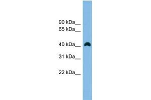 WB Suggested Anti-ANKRD42 Antibody Titration:  0. (ANKRD42 Antikörper  (N-Term))