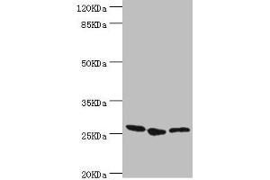 Western blot All lanes: YEATS4 antibody at 1. (GAS41 Antikörper  (AA 1-227))