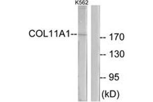 Western blot analysis of extracts from K562 cells, using Collagen XI alpha1 Antibody.