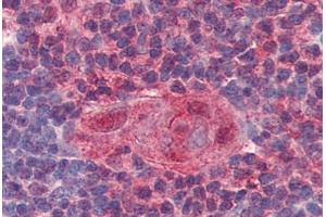 Human Thymus (formalin-fixed, paraffin-embedded) stained with UNG antibody ABIN364332 at 10 ug/ml followed by biotinylated anti-mouse IgG secondary antibody ABIN481714, alkaline phosphatase-streptavidin and chromogen. (UNG Antikörper  (AA 1-313))