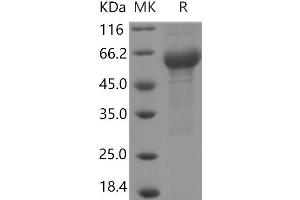 Western Blotting (WB) image for Interleukin 6 Receptor, alpha (IL6RA) (Active) protein (His tag,ECD) (ABIN7321060)