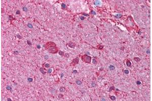 Immunohistochemistry (Paraffin-embedded Sections) (IHC (p)) image for anti-Cholinergic Receptor, Nicotinic, beta 3 (Neuronal) (CHRNB3) (AA 176-225) antibody (ABIN6736369)