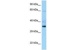 Image no. 1 for anti-Tripartite Motif Containing 44 (TRIM44) (C-Term) antibody (ABIN6748290) (TRIM44 Antikörper  (C-Term))