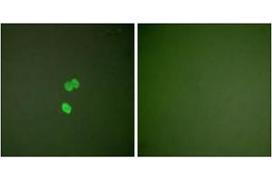 Immunofluorescence analysis of NIH/3T3 cells, using Galectin 3 antibody (ABIN5976406). (Galectin 3 Antikörper  (Internal Region))