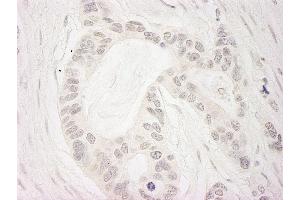 Immunohistochemistry (IHC) image for anti-Budding Uninhibited By Benzimidazoles 1 Homolog beta (Yeast) (BUB1B) (AA 1-50) antibody (ABIN7453860)