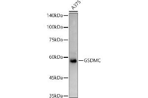 Western blot analysis of extracts of  cells, using GSDMC antibody (ABIN7268463) at 1:1000 dilution. (MLZE Antikörper  (AA 1-100))