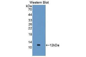 Western Blot; Sample: Recombinant protein. (FGA Antikörper  (AA 554-655))