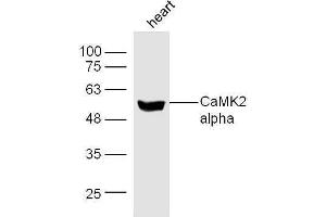 Mouse heart lysates probed with Rabbit Anti-CaMK2 Polyclonal Antibody, Unconjugated  at 1:500 for 90 min at 37˚C (CAMK2B Antikörper  (AA 101-200))