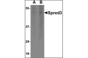 Western blot analysis of Spred3 in human brain tissue lysate with this product at (A) 2 and (B) 4 μg/ml.