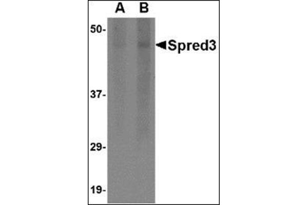 SPRED3 anticorps  (Center)