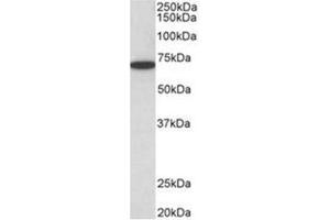 AP31951PU-N HDAC1 antibody staining of HeLa lysate at 0. (HDAC1 Antikörper  (C-Term))