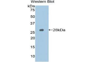 Western blot analysis of the recombinant protein. (SLAMF1 Antikörper  (AA 19-236))