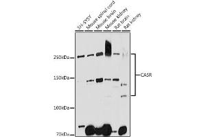 Western blot analysis of extracts of various cell lines, using CASR antibody (ABIN1678994, ABIN5663902, ABIN5663904 and ABIN6218520) at 1:1000 dilution. (CASR Antikörper  (AA 874-1088))
