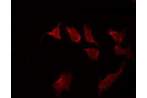 Immunofluorescence (fixed cells) (IF/ICC) image for anti-Signal Transducer and Activator of Transcription 3 (Acute-Phase Response Factor) (STAT3) (pSer727) antibody (ABIN6256411)