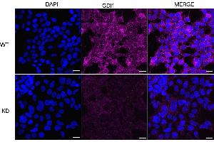 anti-GDP Dissociation Inhibitor 1 (GDI1) antibody