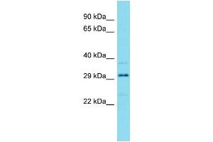 Western Blotting (WB) image for anti-HEAT Repeat Containing 3 (HEATR3) (N-Term) antibody (ABIN2791574) (HEATR3 Antikörper  (N-Term))