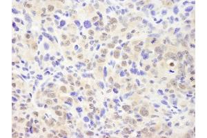 Immunohistochemistry (IHC) image for anti-Casein beta (CSN2) (AA 1-50) antibody (ABIN7448492) (CSN2 Antikörper  (AA 1-50))