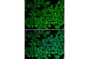 Immunofluorescence analysis of A549 cells using IL12RB1 antibody. (IL12RB1 Antikörper)