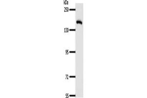 Gel: 8 % SDS-PAGE, Lysate: 40 μg, Lane: Human fetal lung tissue, Primary antibody: ABIN7189710(AFF2 Antibody) at dilution 1/400, Secondary antibody: Goat anti rabbit IgG at 1/8000 dilution, Exposure time: 1 minute