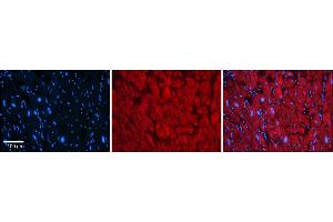 Rabbit Anti-KCNAB2 Antibody    Formalin Fixed Paraffin Embedded Tissue: Human Adult heart  Observed Staining: Cytoplasmic Primary Antibody Concentration: 1:600 Secondary Antibody: Donkey anti-Rabbit-Cy2/3 Secondary Antibody Concentration: 1:200 Magnification: 20X Exposure Time: 0.