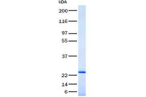 Validation with Western Blot (IL-6 Protein)