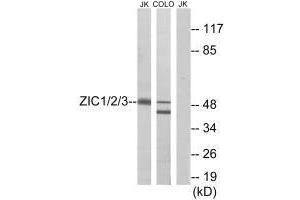 Western blot analysis of extracts from Jurkat cells and COLO cells, using ZIC1/2/3 antibody. (ZIC1 Antikörper)