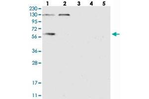 Western blot analysis of Lane 1: RT-4, Lane 2: U-251 MG, Lane 3: Human Plasma, Lane 4: Liver, Lane 5: Tonsil with DYNC1LI1 polyclonal antibody  at 1:250-1:500 dilution.