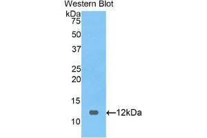 Detection of Recombinant PRAME, Human using Polyclonal Antibody to Preferentially Expressed Antigen In Melanoma (PRAME) (PRAME Antikörper  (AA 416-502))
