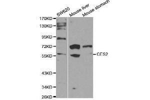Western blot analysis of extracts of various cell lines, using CES2 antibody.