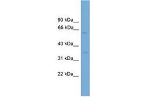Image no. 1 for anti-Major Facilitator Superfamily Domain Containing 8 (MFSD8) (AA 351-400) antibody (ABIN6745584) (MFSD8 Antikörper  (AA 351-400))