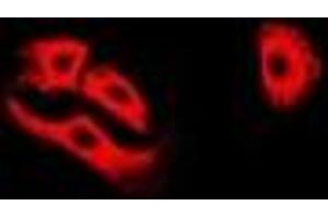 Immunofluorescent analysis of ETFA staining in A549 cells. (ETFA Antikörper)