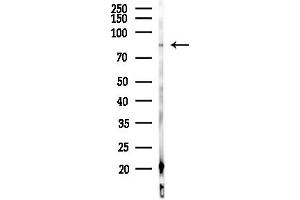 Western blot analysis of lysates from COS-7 cells(heat-shock,45 min treatment), using FRS2 Antibody at 1/1000 dilution.