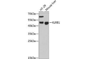Western blot analysis of extracts of various cell lines, using KLRB1 antibody (ABIN6130055, ABIN6142970, ABIN6142972 and ABIN6222669) at 1:3000 dilution. (CD161 Antikörper  (AA 73-140))