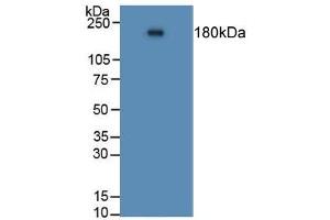 Rabbit Capture antibody from the kit in WB with Positive Control: Human lung tissue. (Angiotensin I Converting Enzyme 1 CLIA Kit)