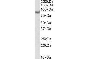 Western Blotting (WB) image for anti-Chromosome 18 Open Reading Frame 8 (C18orf8) (Internal Region) antibody (ABIN2465945) (C18orf8 Antikörper  (Internal Region))