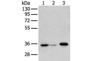 Western blot analysis of HepG2 cell Hela cell and A549 cell using DHRSX Polyclonal Antibody at dilution of 1:350 (DHRSX Antikörper)