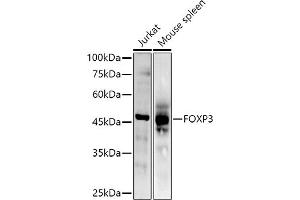 Western blot analysis of extracts of various cell lines, using (ABIN6133706, ABIN6140764, ABIN6140767 and ABIN6215622) at 1:500 dilution. (FOXP3 Antikörper  (AA 50-150))