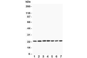 Western blot testing of CNTF antibody and rat samples 1:  PC12;  2: NRK;  3: RH35;  4: brain;  5: liver;  6: spleen;  7: testis lysate. (CNTF Antikörper  (AA 2-200))