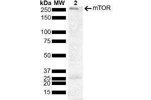 Western blot analysis of Human Cervical cancer cell line (HeLa) lysate showing detection of 288. (MTOR Antikörper  (AA 740-840) (Biotin))