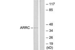 Western blot analysis of extracts from LOVO cells, using ARRC Antibody. (ARR3 Antikörper  (AA 339-388))