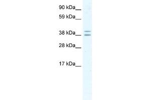 WB Suggested Anti-TSG101 Antibody Titration:  2. (TSG101 Antikörper  (Middle Region))