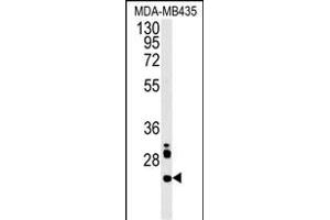 LHPL3 Antibody (C-term) (ABIN651908 and ABIN2840448) western blot analysis in MDA-M cell line lysates (15 μg/lane). (LHFPL3 Antikörper  (C-Term))