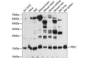 Western blot analysis of extracts of various cell lines, using PPIL1 antibody (ABIN7269211) at 1:1000 dilution. (PPIL1 Antikörper  (AA 1-166))