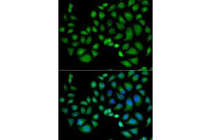 Immunofluorescence analysis of HeLa cells using CLIC1 antibody. (CLIC1 Antikörper)
